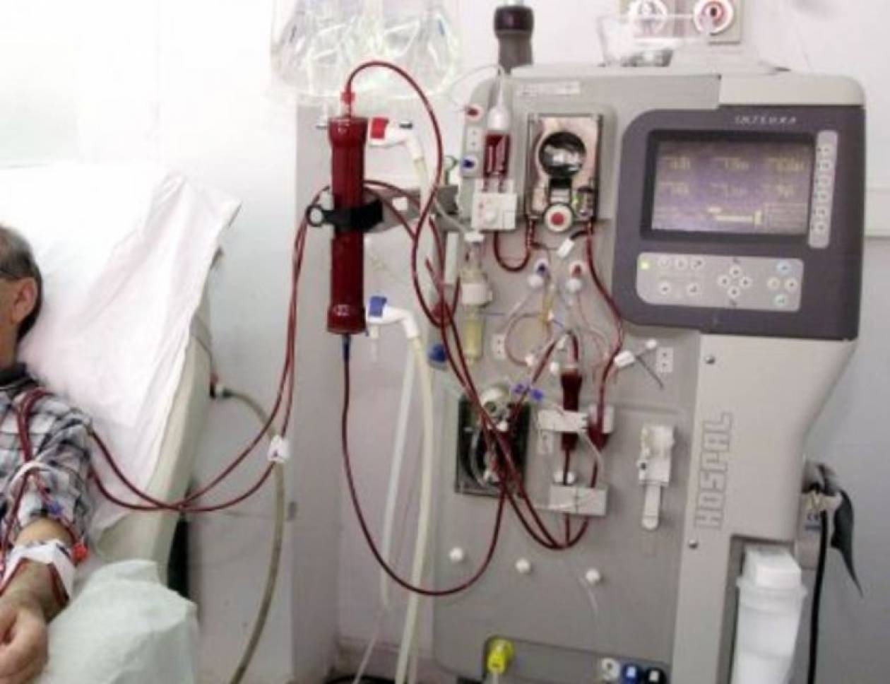 Κινδυνεύουν 70 νεφροπαθείς στη Μαγνησία