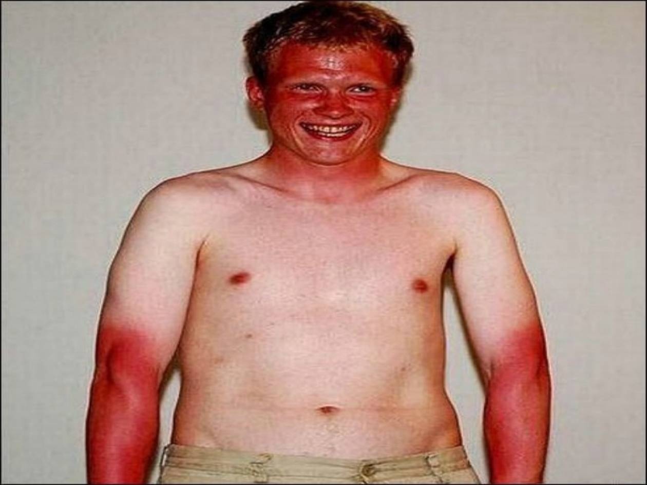 10 κωμικοτραγικά μαυρίσματα! (pics)