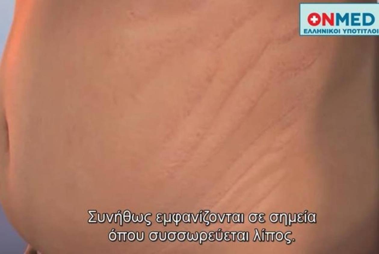Δείτε πώς δημιουργούνται οι ραγάδες
