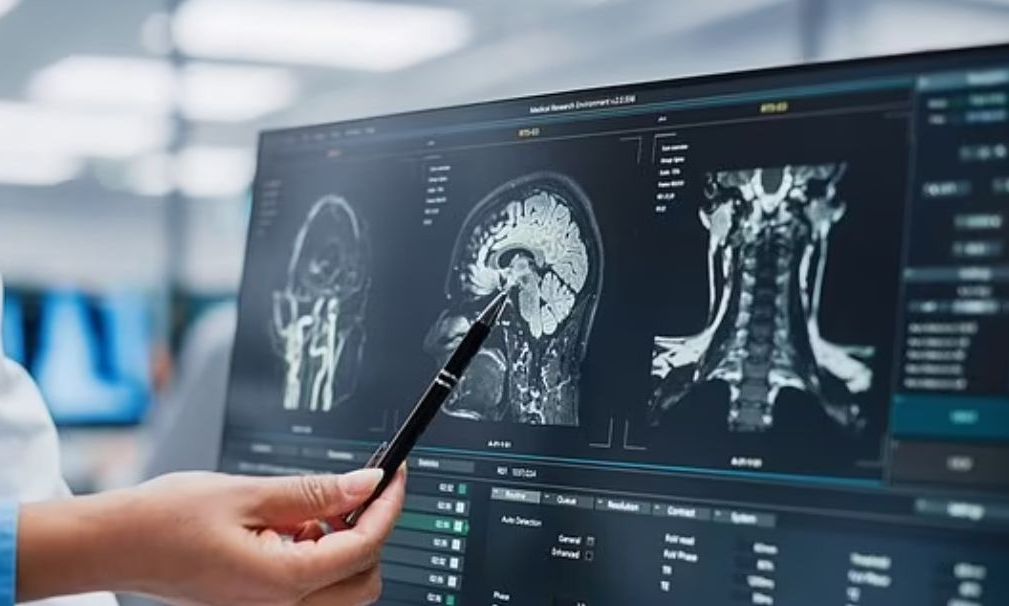 Ποιες είναι οι πέντε «εποχές» του εγκεφάλου - Σε ποια δεκαετία «ενηλικιωνόμαστε»