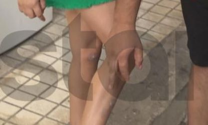 Σεπόλια – Απόπειρα απαγωγής 9χρονης: Την παρέσυρε με το ΙΧ και την τραυμάτισε Όλες οι ειδήσεις