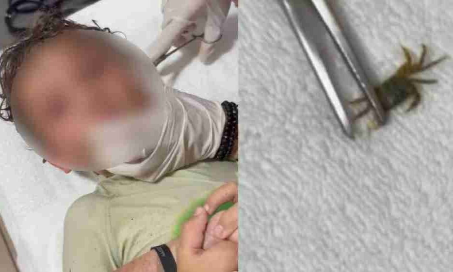 Μεξικό: Φριχτή δοκιμασία για αγοράκι - Γιατροί έβγαλαν ζωντανό καβούρι από το αυτί του