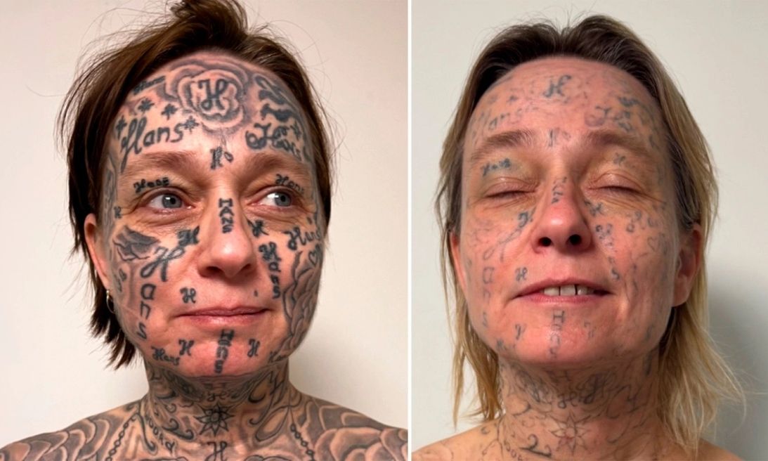 Σάλος στην Ολλανδία:  Έκανε τατουάζ 250 φορές το όνομά του στο σώμα της κοπέλας του