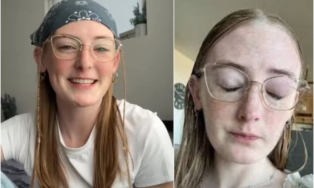 Νεαρή Αμερικανίδα έκανε μπάνιο με τους φακούς επαφής και έχασε την όρασή της μέσα σε λίγες μέρες