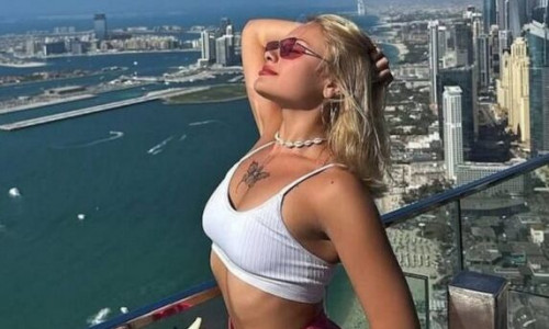 Πάρτι «porta potty»: Σε αμαξίδιο η Ουκρανή influencer - Της λείπουν 10 εκατοστά οστού από το πόδι