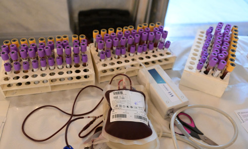 Λάθος στη μετάγγιση αίματος: Τι απαντά η Ευρωκλινική στο Newsbomb