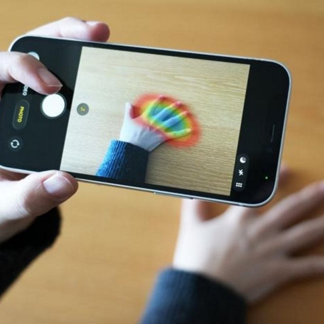 Με μια απλή φωτογραφία του χεριού θα μπορείτε να ανιχνεύσετε σπάνια διαταραχή υγείας