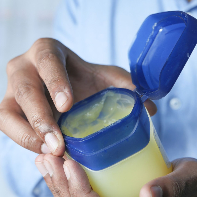 Βαζελίνη: Οφέλη υγείας, χρήσεις - Τι θέλουν να γνωρίζετε οι δερματολόγοι