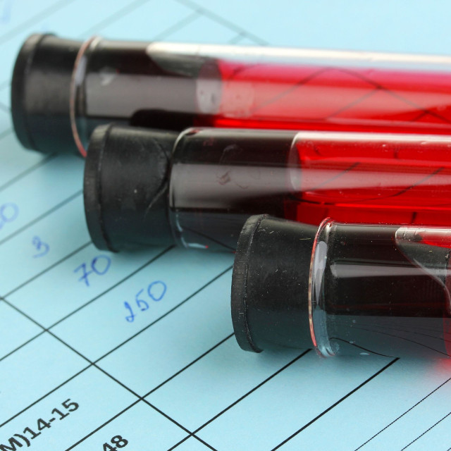 Οι 4 πρωτοπαθείς καρκίνοι που αυξάνουν την πιθανότητα μετέπειτα λευχαιμίας