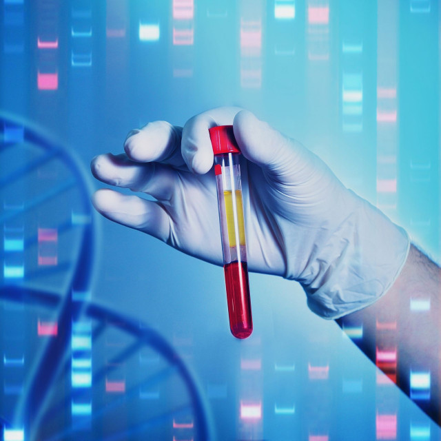 Ανέπτυξαν τεστ ανίχνευσης πολλαπλών καρκίνων και άλλων ασθενειών από ένα μόνο δείγμα αίματος