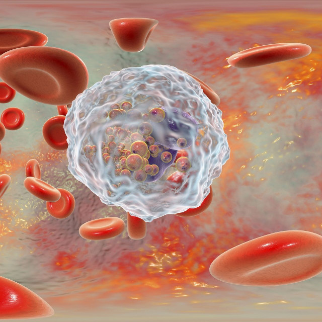 Μελέτη για τη σχέση των εμβολίων της COVID-19 και νόσων του αίματος - «Ξύπνησε» λανθάνουσα διαραχή;