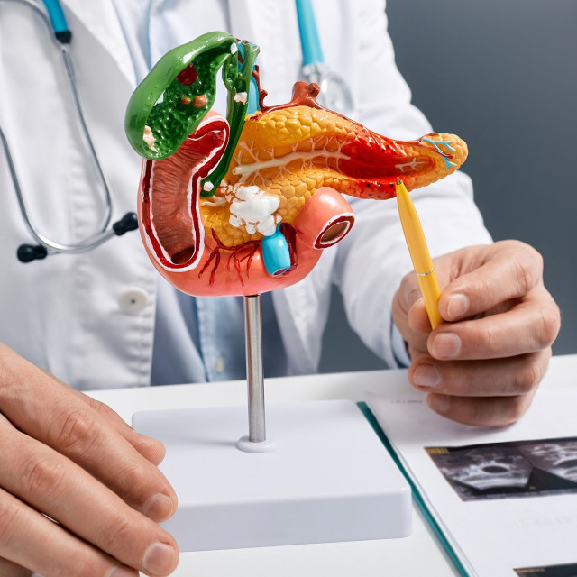 Δύο πειραματικά φάρμακα φέρνουν ελπίδα για τον καρκίνο του παγκρέατος