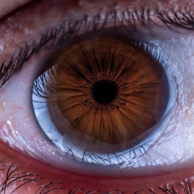 Επιστήμονες λαμβάνουν το “Όσκαρ της επιστήμης” για γενετική θεραπεία που βελτιώνει την όραση