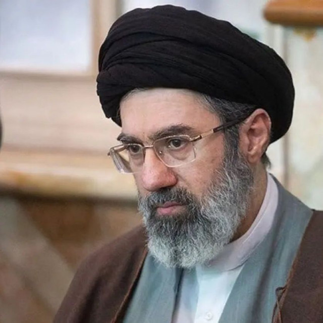 Μοτζταμπά Χαμενεΐ: Το πρόσωπό του είναι τόσο παραμορφωμένο που θα χρειαστεί πλαστική επέμβαση