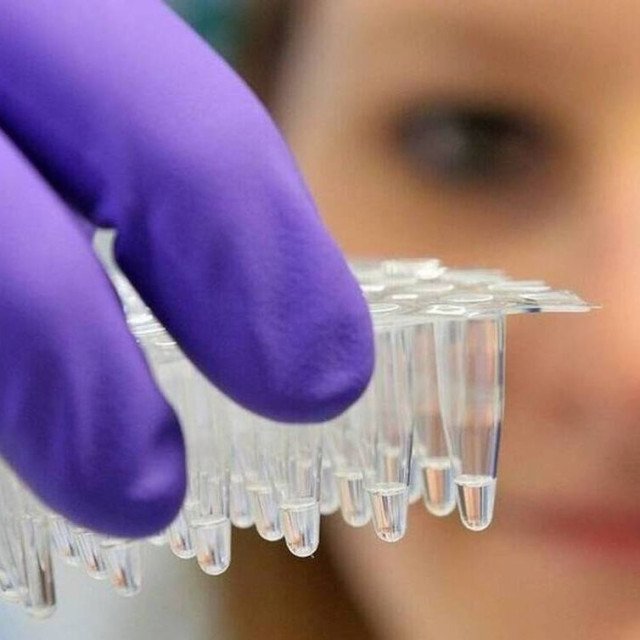 Πόσο έτοιμοι είμαστε για την επόμενη πανδημία; Τι δείχνει μια νέα δοκιμή mRNA εμβολίου