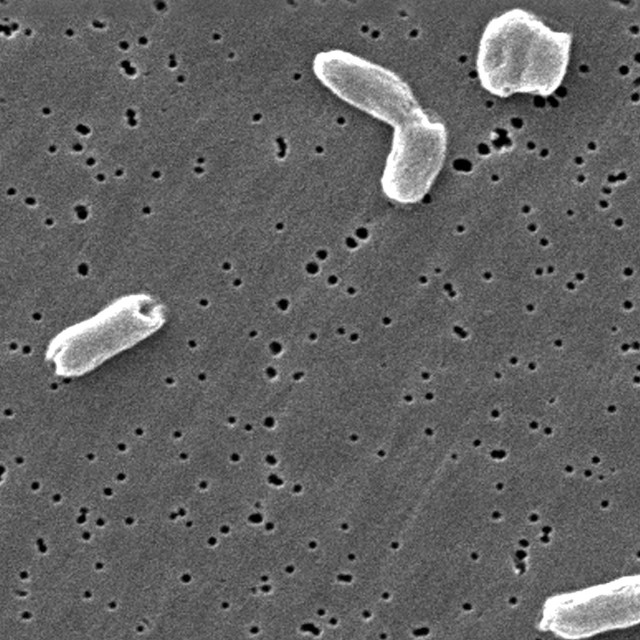 ΕΦΕΤ: Ανακαλούνται παρτίδες αποξηραμένου βότανου – Εντοπίστηκε σαλμονέλα