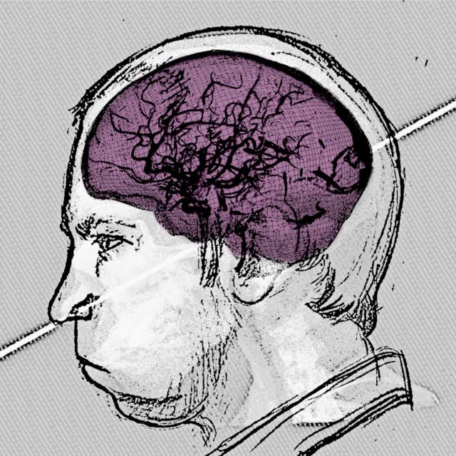 Ο σοβιετικός επιστήμονας που επέζησε από την πρόσκρουση μιας δέσμης πρωτονίων στο κεφάλι του