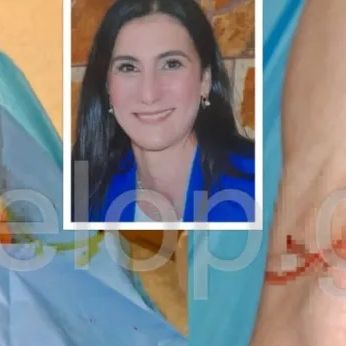 Πάτρα: Άγριος ξυλοδαρμός γυναίκας - Την ξυλοκόπησαν και την πέταξαν σε χαντάκι