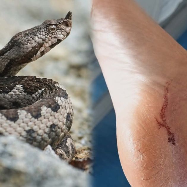 Αγρίνιο: Φίδι δάγκωσε και τραυμάτισε γυναίκα - Δείτε βίντεο