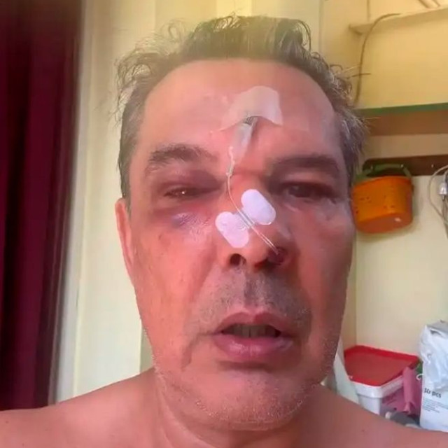 Ξυλοκόπησε άγρια άνδρα μέσα σε ιατρείο όταν του έκανε παρατήρηση να μιλά πιο σιγά στο κινητό