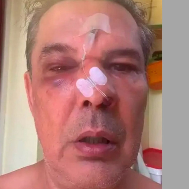 Χαϊδάρι: Τι δήλωσε το θύμα ξυλοδαρμού από «τραμπούκο» σε ιατρείο - Γνωστός επιχειρηματίας ο δράστης