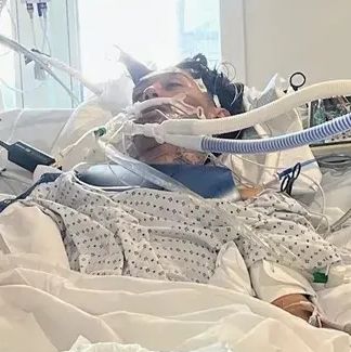 Έφηβος στη Βόρεια Καρολίνα πέθανε από λοίμωξη που προκαλείται από αμοιβάδα που τρώει τον εγκέφαλο
