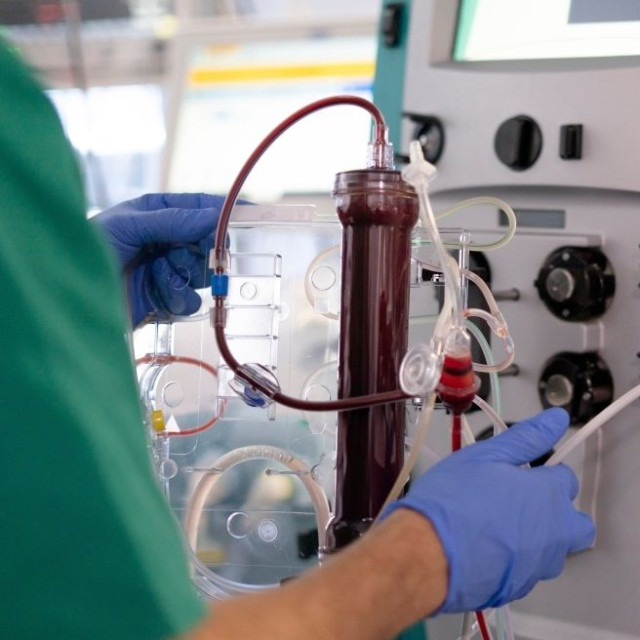 Έρευνα και στην Κύπρο για κέντρα πλασμαφαίρεσης - Στο μικροσκόπιο άδειες, γιατροί και εξοπλισμός