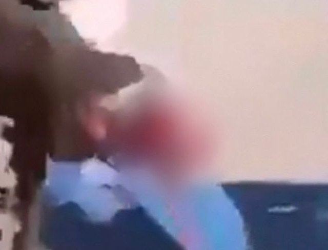 Προσοχή, σκληρές εικόνες: Μαθητής στη Γαλλία ακρωτηριάστηκε στο χέρι από χειροβομβίδα κρότου – λάμψης, κατά τη διάρκεια διαδήλωσης