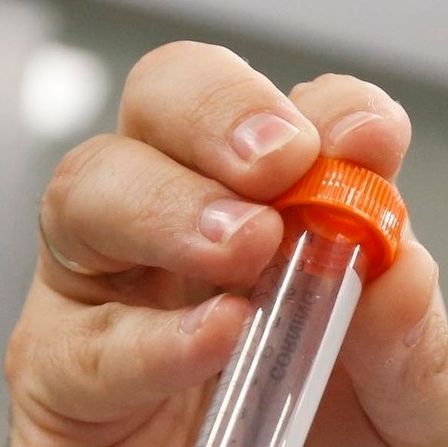 Eπιστήμονες ανακάλυψαν ότι ένα πολύ γνωστό μικρόβιο έχει την ικανότητα να μειώνει τη χοληστερόλη