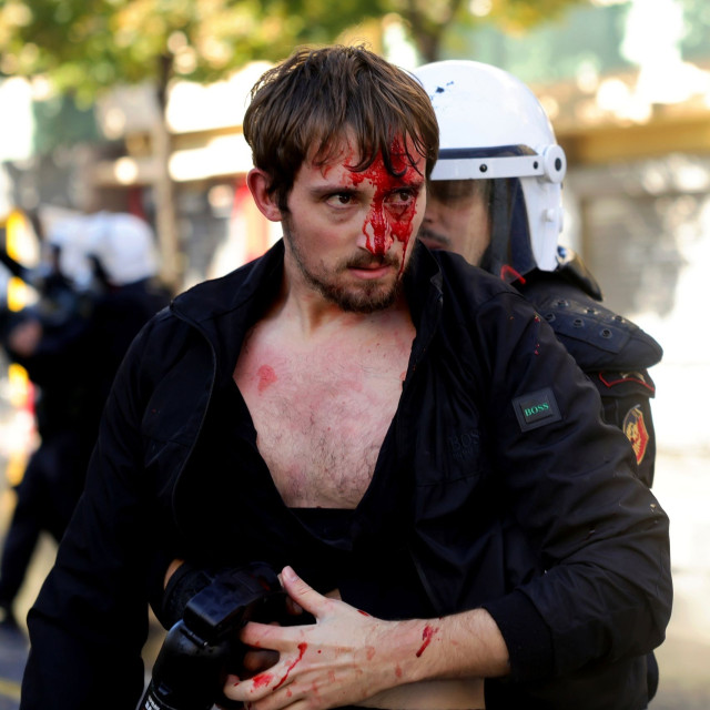 Χάος στην Αλβανία: Εισβολή φοιτητών στο υπουργείο Παιδείας, εμπρησμοί και μάχες σώμα με σώμα