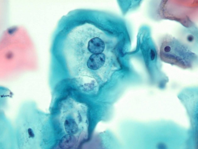 Εμβολιασμός έναντι του ιού HPV, που προκαλεί  καρκίνο και άλλα σοβαρά νοσήματα