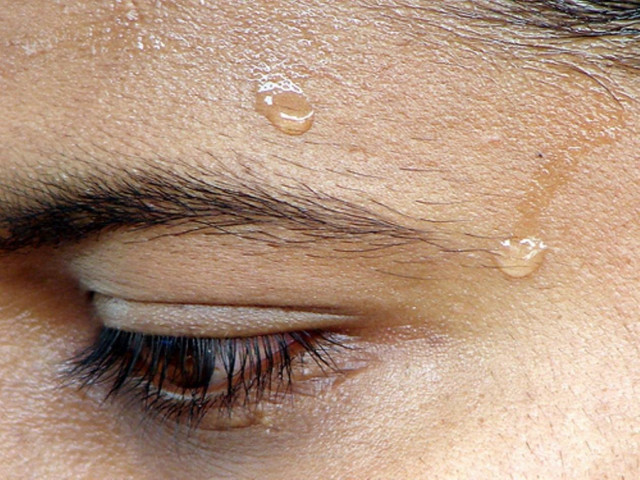 Υπεριδρωσία: Δυσάρεστη αλλά θεραπεύεται