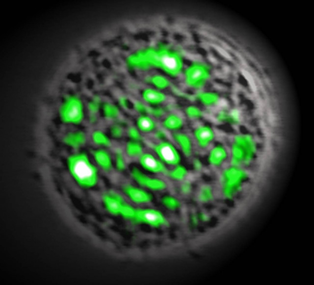 Κύτταρο μετατράπηκε σε λέιζερ