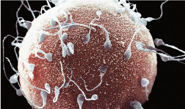 Γενετική μετάλλαξη ευθύνεται για την υπογονιμότητα