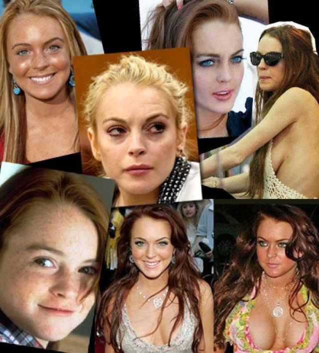 Πόσες πλαστικές έχει κάνει τελικά η Lindsay Lohan;