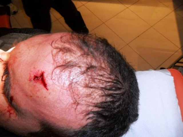 Σάμος: του άνοιξαν το κεφάλι για τις εισπράξεις