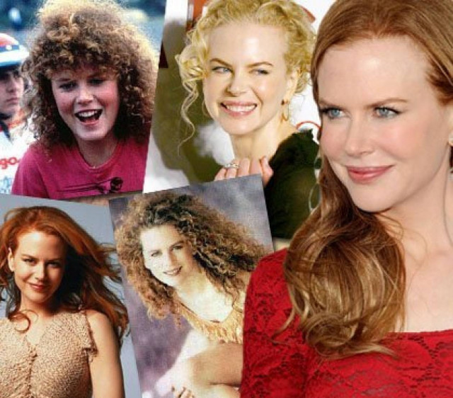 Τότε και τώρα: Nicole Kidman, μπούκλες και μπότοξ