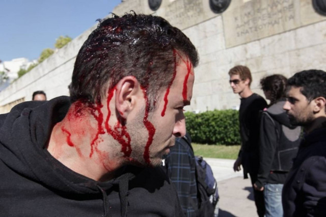 Δεκάδες τραυματίες από τα άγρια επεισόδια