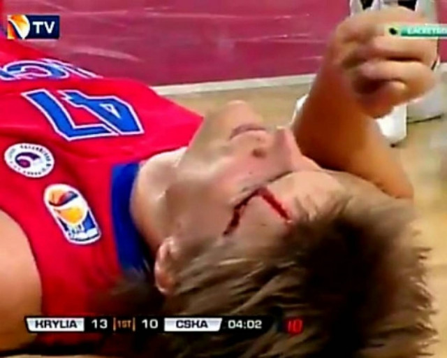 Δείτε τον σοκαριστικό τραυματισμό του Κιριλένκο της ΤΣΣΚΑ