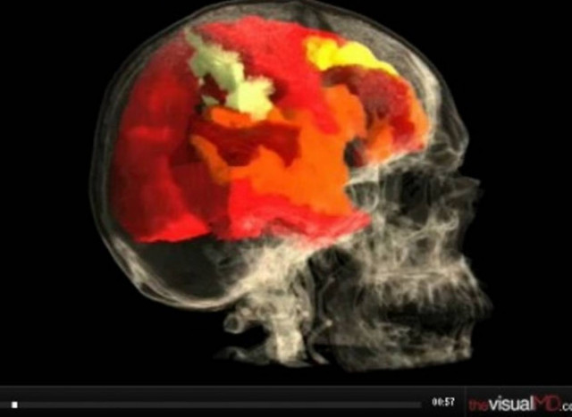 Το… ουράνιο τόξο του γυναικείου οργασμού