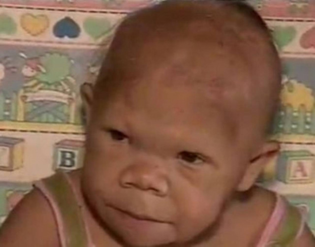 Γυναίκα 30 ετών με όψη μωρού