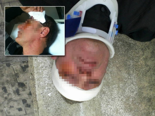 Δολοφονική η επίθεση στον ρεπόρτερ του Newsbomb