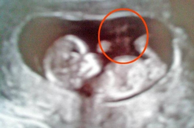 Είδε την πεθαμένη γιαγιά της στο υπερηχογράφημα