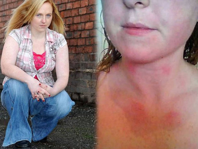 Αλλεργική στα δάκρυά της!