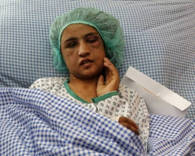 Παραμένει στο νοσοκομείο η 15χρονη που βασανίστηκε από τα πεθερικά της