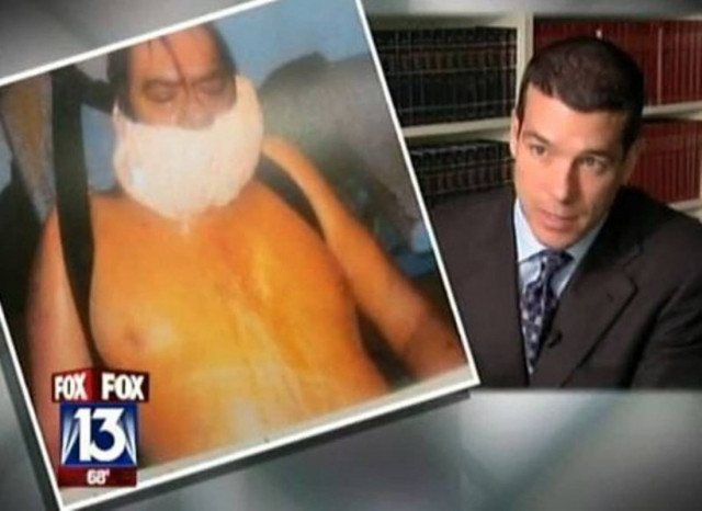 Αστυνομικοί σκότωσαν συνταξιούχο με σπρέι πιπεριού!