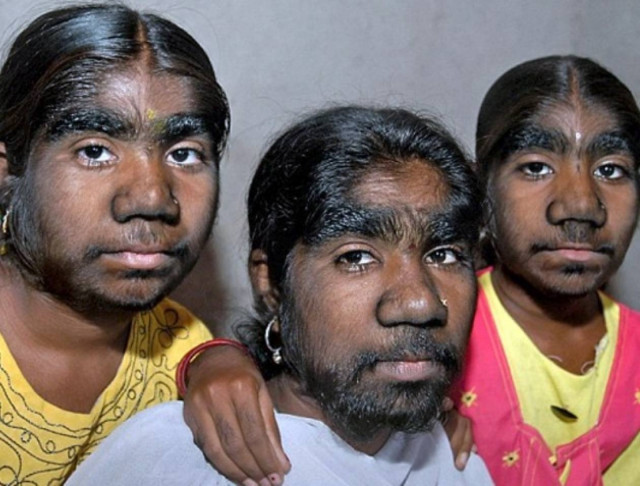 Kορίτσια- λυκάνθρωποι στην Ινδία