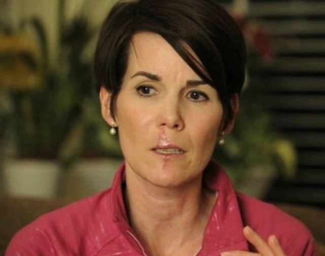 Παρουσιάστρια που δαγκώθηκε από σκύλο μιλά για την εμπειρία της