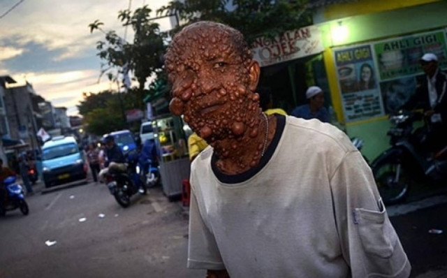 Είναι 51 και δεν έχει νιώσει το φιλί