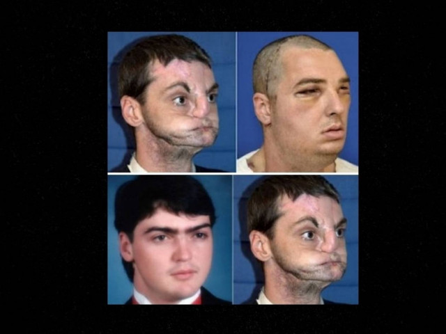 Μετά από 15 χρόνια απέκτησε νέο πρόσωπο